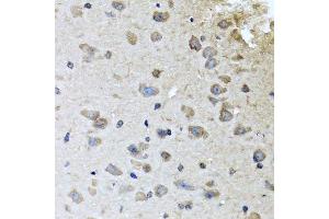 Immunohistochemistry of paraffin-embedded mouse brain using BRCA1 antibody. (BRCA1 anticorps  (AA 120-220))