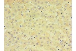 Immunohistochemistry of paraffin-embedded human liver tissue using ABIN7149253 at dilution of 1:100