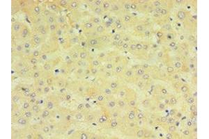 Immunohistochemistry of paraffin-embedded human liver tissue using ABIN7149253 at dilution of 1:100 (CYP2J2 anticorps  (AA 328-502))