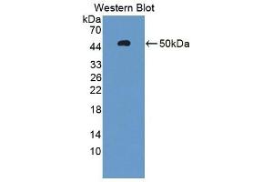 Detection of Recombinant AHRR, Human using Polyclonal Antibody to Aryl Hydrocarbon Receptor Repressor (AHRR) (AHRR anticorps  (AA 1-182))
