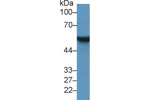 Detection of GFAP in Rat Cerebrum lysate using Monoclonal Antibody to Glial Fibrillary Acidic Protein (GFAP)