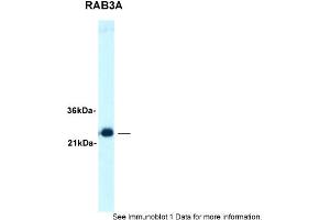 Sample Type: Human brainSecondary Antibody: TIgG product, 1. (RAB3A anticorps  (C-Term))