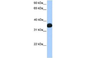 LDHB antibody used at 1 ug/ml to detect target protein. (LDHB anticorps  (C-Term))