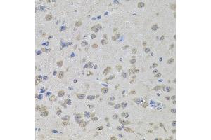 Immunohistochemistry of paraffin-embedded mouse brain using MAPK1 antibody (ABIN4904300) at dilution of 1:100 (40x lens).