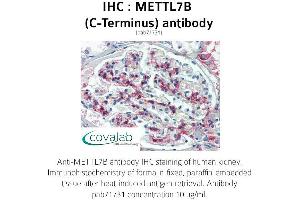 Image no. 2 for anti-Methyltransferase Like 7B (METTL7B) (C-Term) antibody (ABIN1736925) (METTL7B anticorps  (C-Term))