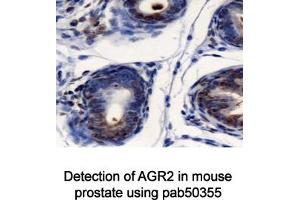 Image no. 1 for anti-Anterior Gradient Homolog 2 (Xenopus Laevis) (AGR2) (AA 50-100) antibody (ABIN363664) (AGR2 anticorps  (AA 50-100))