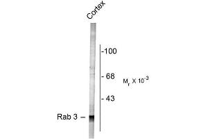 Image no. 1 for anti-RAB3A, Member RAS Oncogene Family (RAB3A) (N-Term) antibody (ABIN372708) (RAB3A anticorps  (N-Term))
