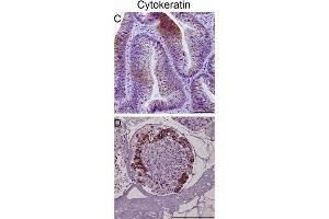 Immunohistochemical staining of tumor biopsy and biopsy spheroid sections. (KRT20 anticorps)