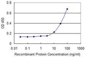anti-Arachidonate 15-Lipoxygenase B (ALOX15B) (AA 181-280) antibody