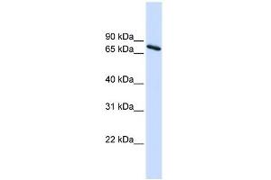 Ubiquilin 1 antibody used at 1 ug/ml to detect target protein.