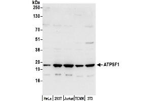 Western Blotting (WB) image for anti-ATP Synthase, H+ Transporting, Mitochondrial Fo Complex, Subunit B1 (ATP5F1) (AA 206-256) antibody (ABIN7450008)