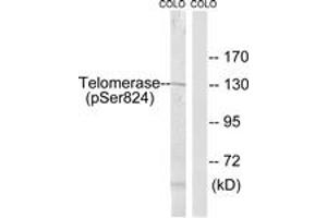 Western blot analysis of extracts from COLO205 cells, using Telomerase (Phospho-Ser824) Antibody. (TERT anticorps  (pSer824))