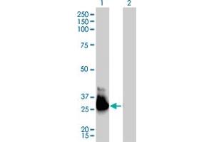 Western Blot analysis of GNA13 expression in transfected 293T cell line by GNA13 monoclonal antibody (M01), clone 6F6-B5. (GNA13 anticorps  (AA 1-377))