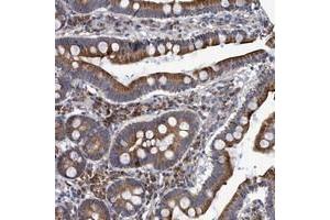 Immunohistochemical staining of human duodenum with NAT16 polyclonal antibody  shows cytoplasmic positivity in glandular cells. (NAT16 anticorps)