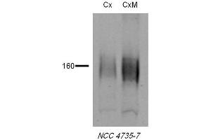 Western blot analysis of Rat tissue lysates showing detection of NCC protein using Rabbit Anti-NCC Polyclonal Antibody . (SLC12A3 anticorps  (AA 74-95) (Atto 390))