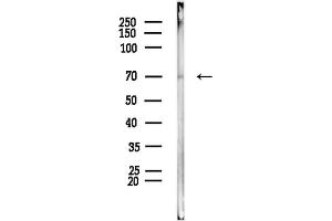 anti-T-Box 2 (TBX2) (C-Term) antibody