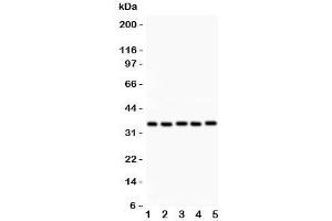 Western blot testing of HOXA11 antibody and Lane 1:  rat brain;  2: human placenta;  3: human HeLa;  4: (h) HT1080;  5: mouse HEPA lysate. (Homeobox A11 anticorps  (AA 74-245))