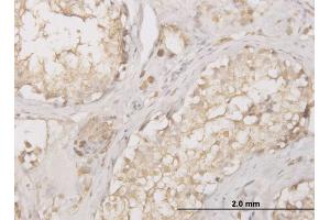 Immunoperoxidase of monoclonal antibody to CTSD on formalin-fixed paraffin-embedded human testis. (Cathepsin D anticorps  (AA 26-412))