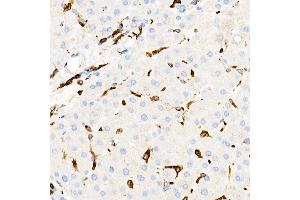 Immunohistochemistry of paraffin-embedded Human liver using CD74 antibody (ABIN7267759) at dilution of 1:100 (40x lens).