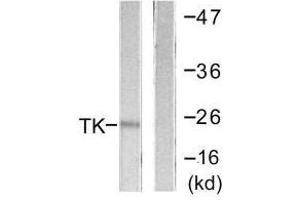 Western blot analysis of extracts from COLO205 cells, using TK (Ab-13) antibody. (TK1 anticorps  (Ser13))