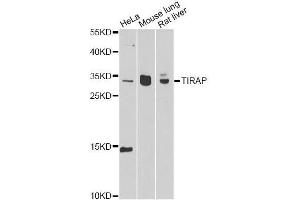 Western blot analysis of extracts of various cell lines, using TIRAP antibody. (TIRAP anticorps  (AA 1-221))