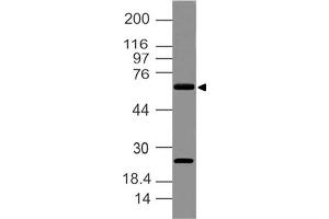 Image no. 1 for anti-delta Like Protein 3 (DLL3) (AA 62-286) antibody (ABIN5027148) (DLL3 anticorps  (AA 62-286))
