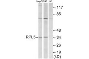 Western blot analysis of extracts from Jurkat/HepG2 cells, using RPL5 Antibody. (RPL5 anticorps  (AA 161-210))