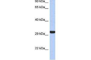WB Suggested Anti-GZMK Antibody Titration:  0.