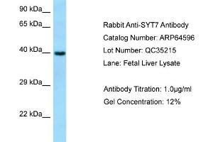 Western Blotting (WB) image for anti-Synaptotagmin VII (SYT7) (N-Term) antibody (ABIN971838) (SYT7 anticorps  (N-Term))