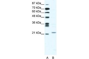 WB Suggested Anti-TWIST1 Antibody Titration:  2. (TWIST1 anticorps  (C-Term))