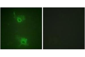 Immunofluorescence analysis of COS7 cells, using S1P Receptor EDG1 (Phospho-Thr236) Antibody. (S1PR1 anticorps  (pThr236))