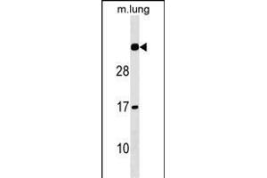 NAT15 Antibody (Center) (ABIN1537826 and ABIN2849865) western blot analysis in mouse lung tissue lysates (35 μg/lane). (NAT15 anticorps  (AA 133-160))