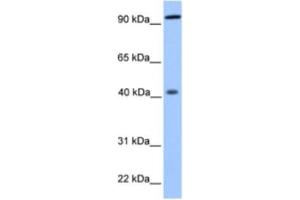 Western Blotting (WB) image for anti-Pygopus Homolog 1 (Drosophila) (PYGO1) antibody (ABIN2463350) (PYGO1 anticorps)