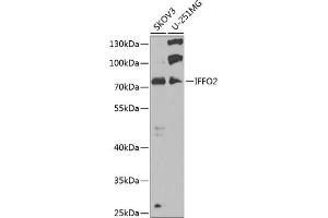 Western blot analysis of extracts of various cell lines, using IFFO2 antibody (ABIN6133429, ABIN6142160, ABIN6142161 and ABIN6223442) at 1:1000 dilution. (IFFO2 anticorps)