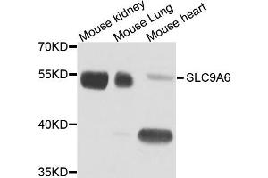 Western blot analysis of extract of various cells, using SLC9A6 antibody. (SLC9A6 anticorps)