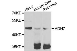 Western blot analysis of extracts of various cell lines, using ADH7 antibody. (ADH7 anticorps)