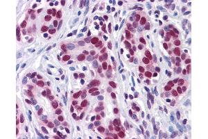Anti-HuR antibody IHC of human breast. (ELAVL1 anticorps  (AA 1-101))