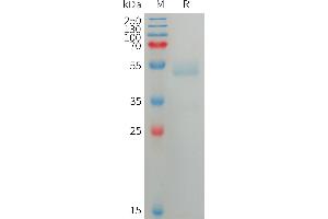Human ANG Protein, His Tag on SDS-PAGE under reducing condition.