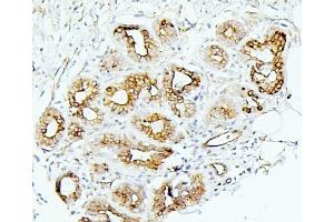 IHC analysis of MMP1 using anti-MMP1 antibody (ABIN7599873).