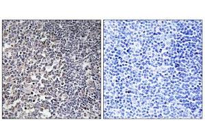 Immunohistochemistry analysis of paraffin-embedded human tonsil tissue using MRPS16 antibody. (MRPS16 anticorps  (Internal Region))