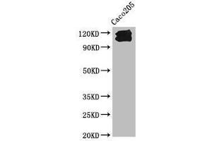 Western Blot Positive WB detected in: Caco205 whole cell lysate All lanes: CDH1 antibody at 1:1000 Secondary Goat polyclonal to Mouse IgG at 1/10000 dilution Predicted band size: 98, 91 kDa Observed band size: 110, 120 kDa