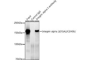 Immunoprecipitation analysis of 300 μg extracts of A-549 cells using 3 μg Integrin alpha 2 (ITG/CD49b) antibody . (ITGA2 anticorps)