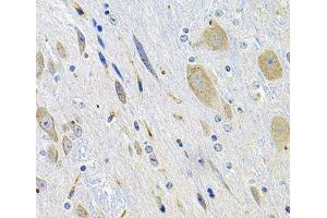 Immunohistochemistry of paraffin-embedded Mouse brain using LGR6 Polyclonal Antibody at dilution of 1:100 (40x lens). (LGR6 anticorps)