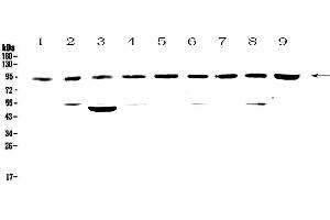 Western blot analysis of Cullin 5 using anti-Cullin 5 antibody . (Cullin 5 anticorps  (AA 2-105))