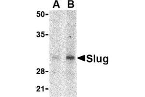Western Blotting (WB) image for anti-SLUG (Middle Region 1) antibody (ABIN1031191) (SLUG anticorps  (Middle Region 1))