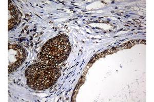 Image no. 9 for anti-Nibrin (NBN) (AA 461-754) antibody (ABIN1491539)