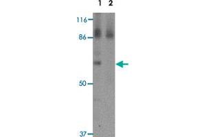 Western blot analysis of RBM35A in rat colon tissue lysate with RBM35A polyclonal antibody  at 0. (ESRP1 anticorps  (N-Term))