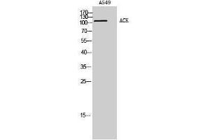 Western Blotting (WB) image for anti-tyrosine Kinase, Non-Receptor, 2 (TNK2) (Tyr530) antibody (ABIN3178052) (TNK2 anticorps  (Tyr530))
