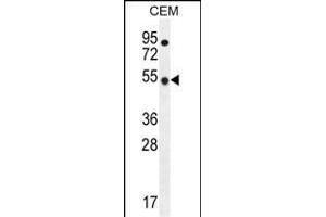 TBC1D13 Antibody (Center) (ABIN655819 and ABIN2845243) western blot analysis in CEM cell line lysates (35 μg/lane). (TBC1D13 anticorps  (AA 76-105))
