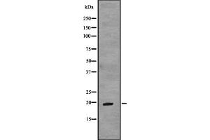 Western blot analysis of TCAP expression in Fetal muscle lysate Fetal heart lysate,The lane on the left is treated with the antigen-specific peptide. (TCAP anticorps  (N-Term))